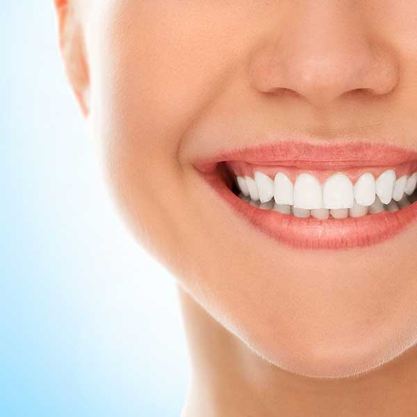 Zahnspangen zur kieferorthopädischen Behandlung bei Fehlstellungen der Zähne 