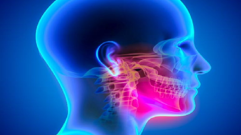 CMD Craniomandibuläre Dysfunktion- Kiefergelenks-Behandlungen – Bruxismus Knirschen